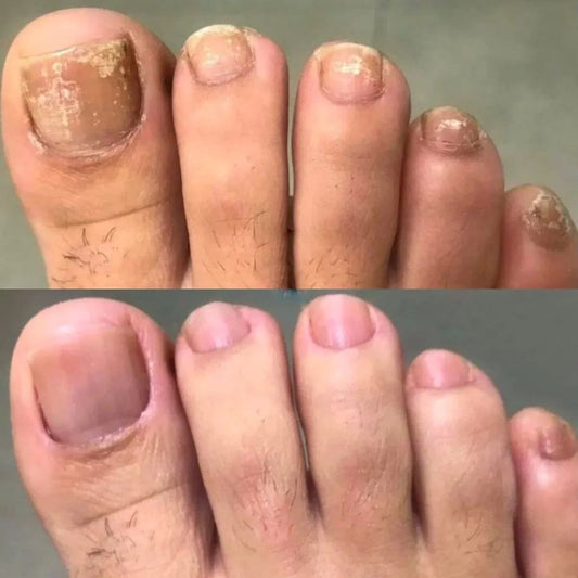 NagelVitaal