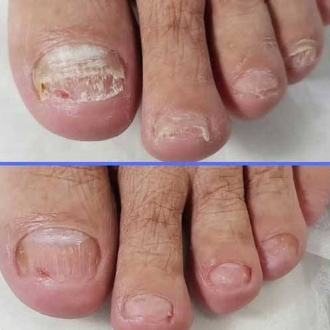 NagelPro