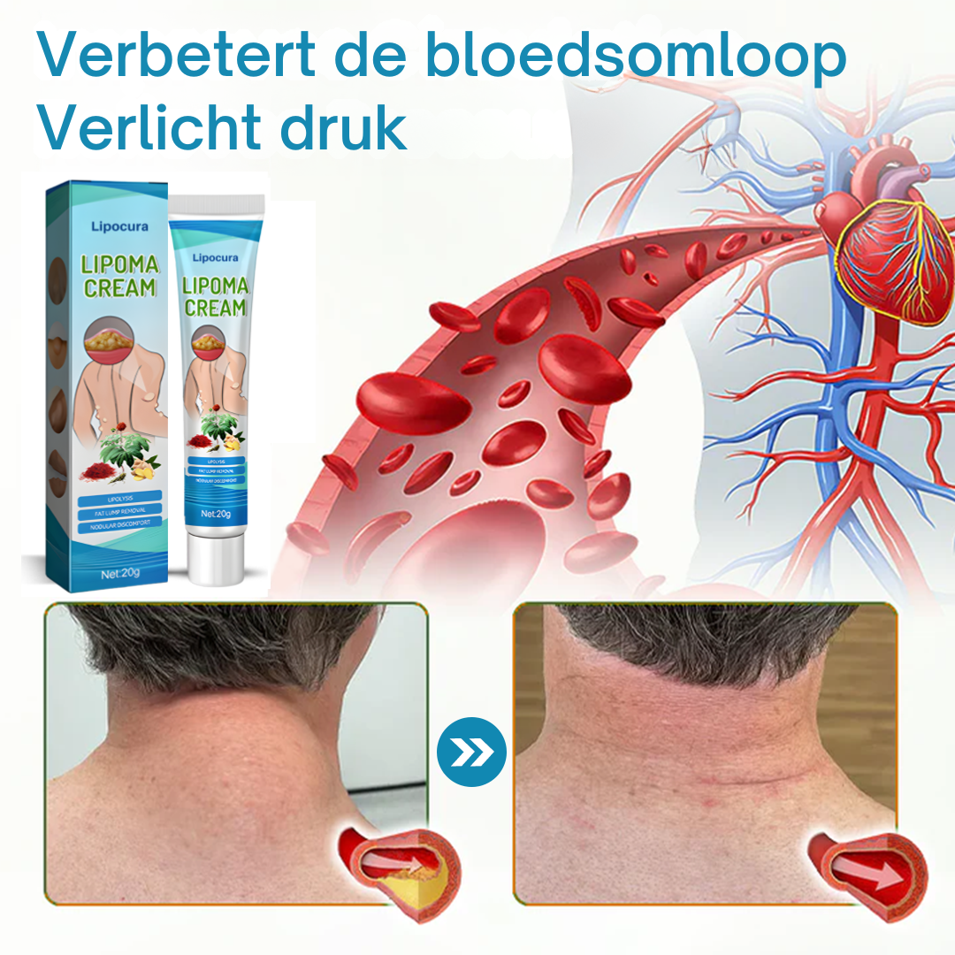 Lipocura