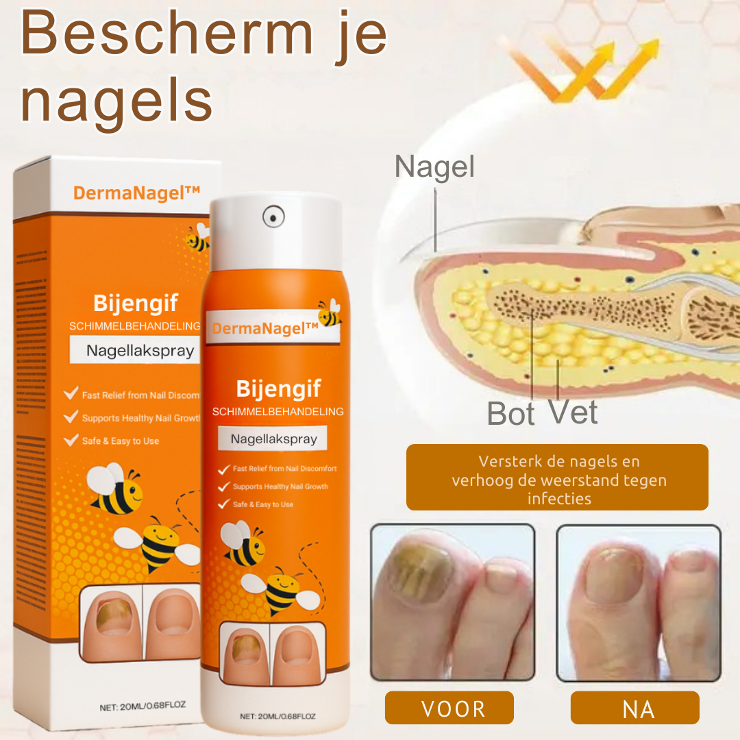 DermaNagel