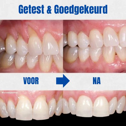 GumVitaal
