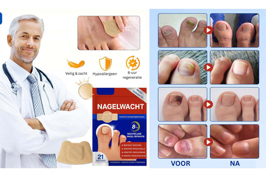 NagelWacht