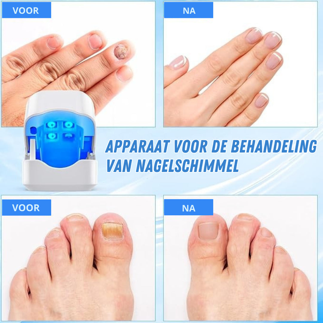 NagelZuiver