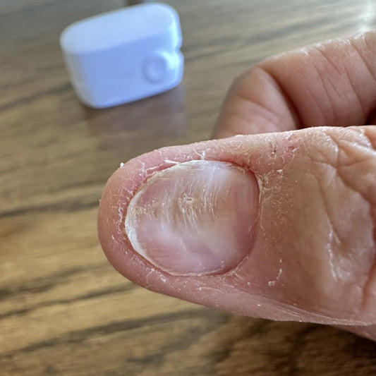 NagelZuiver
