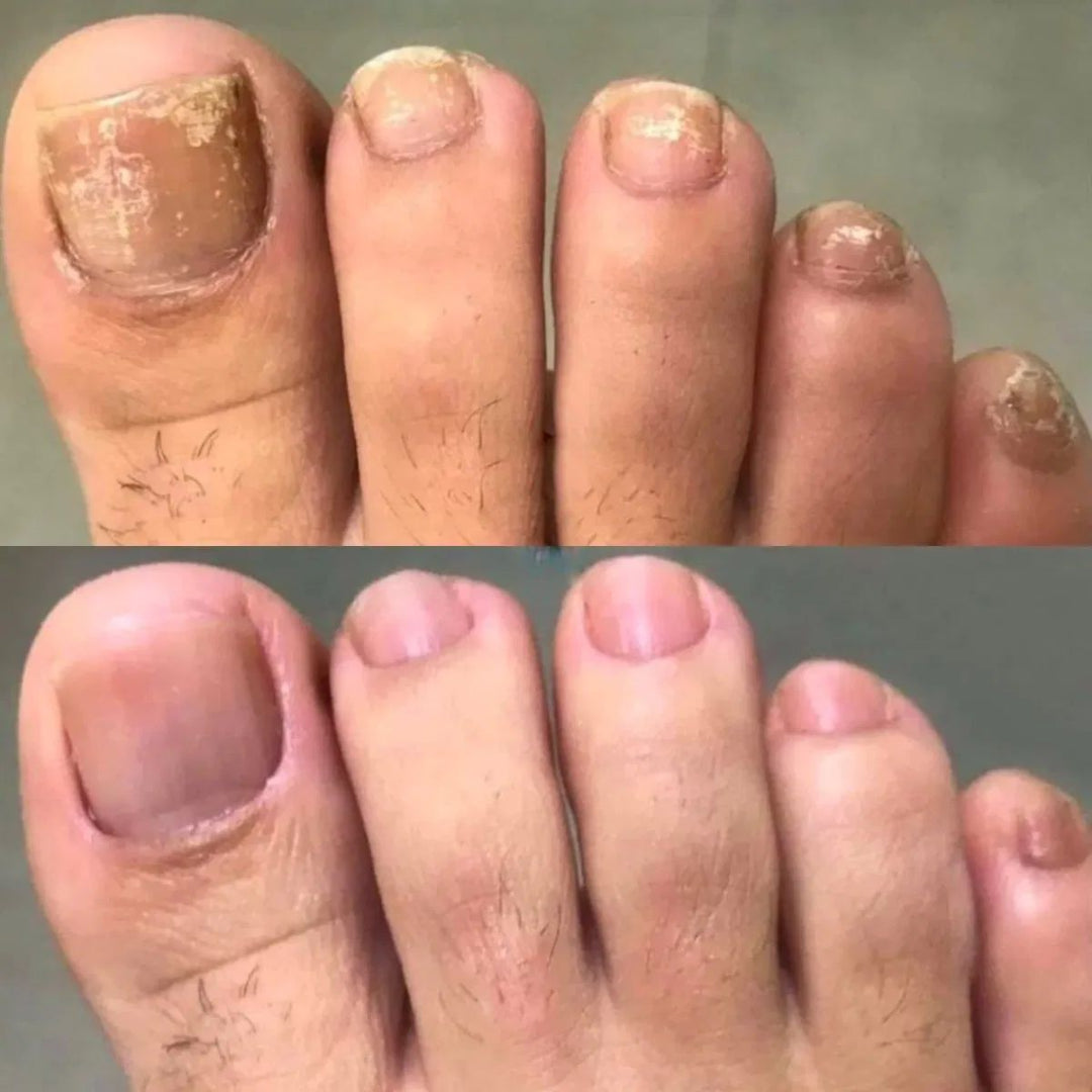 NagelVitaal