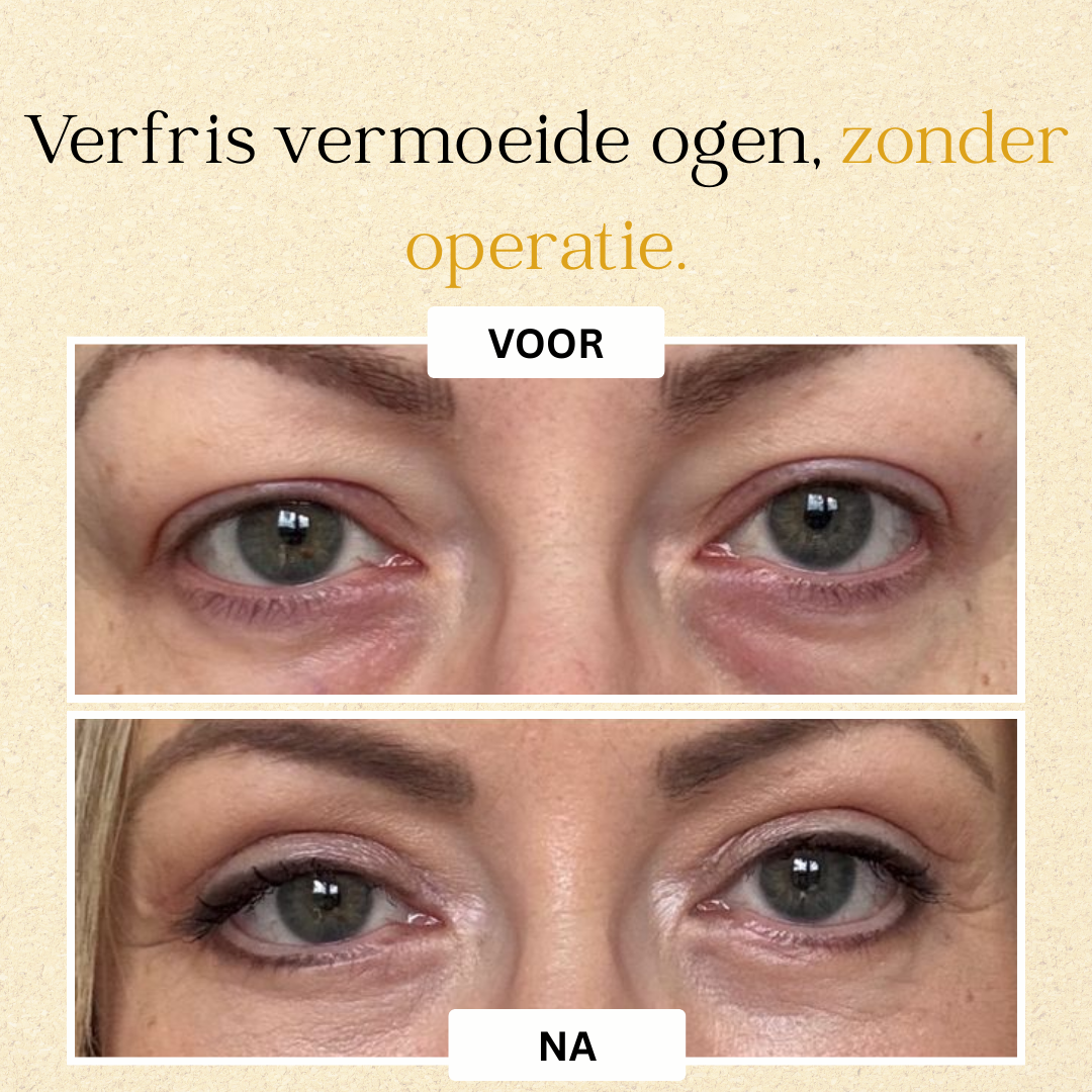 Oogèra