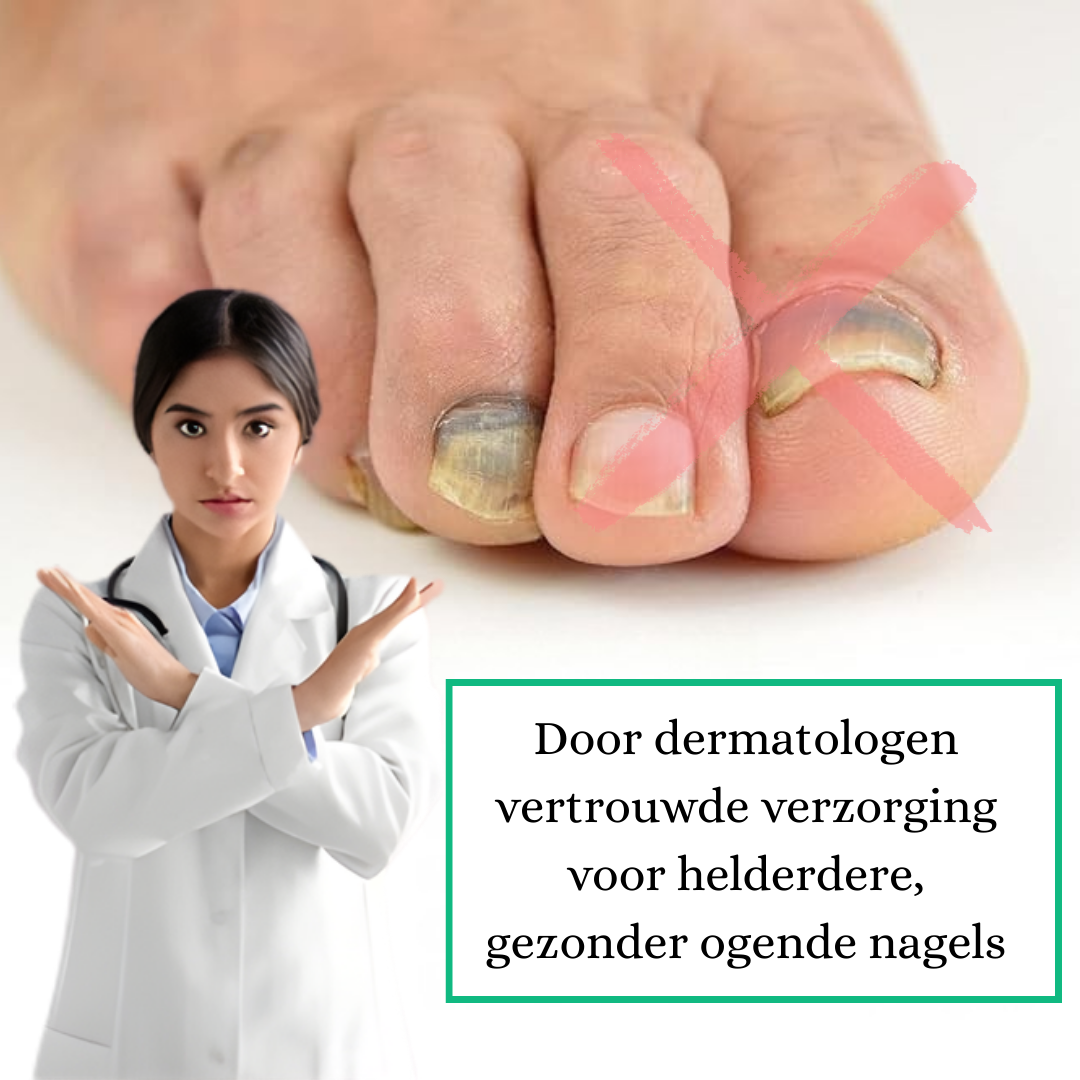 MycoHerstel