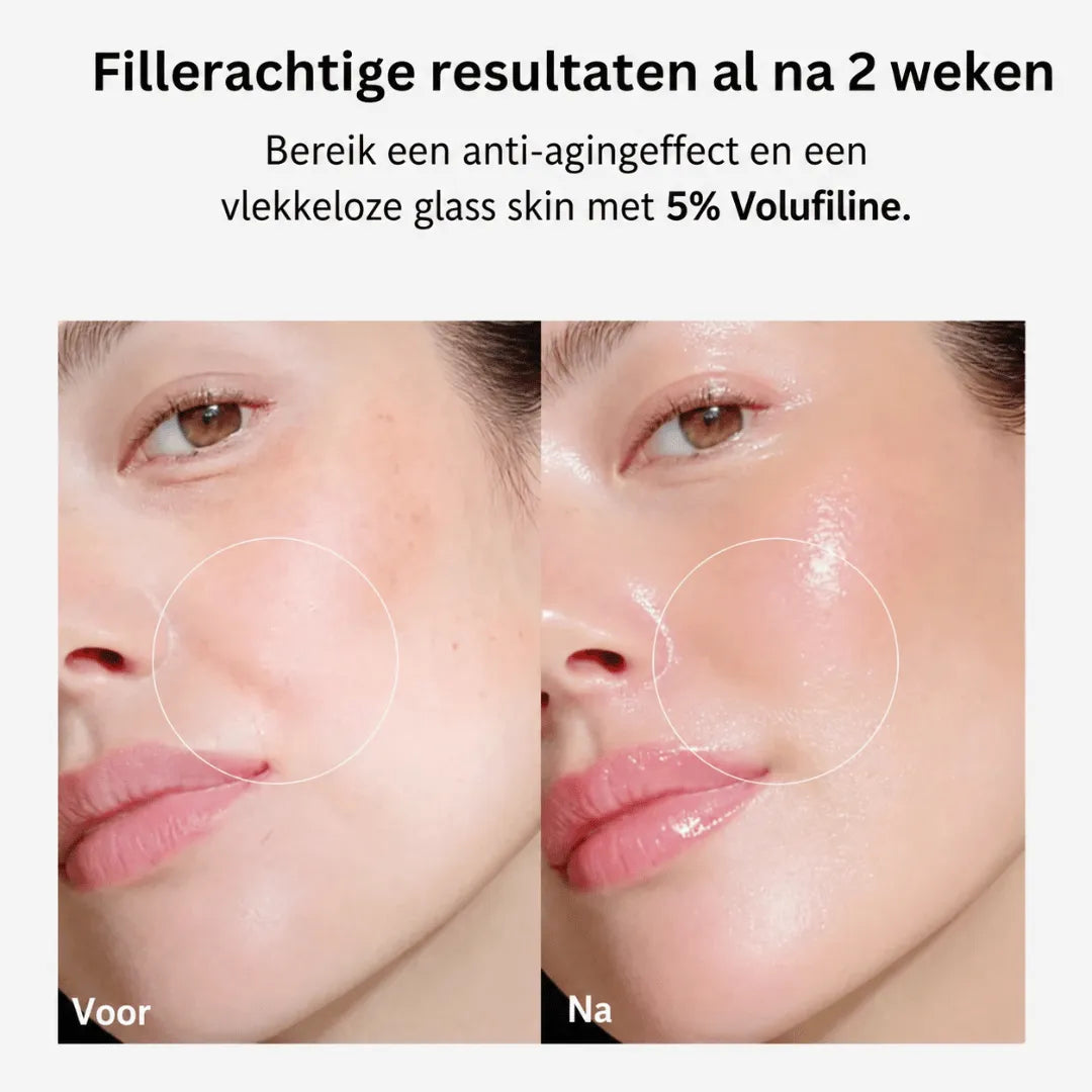 VoluDerm