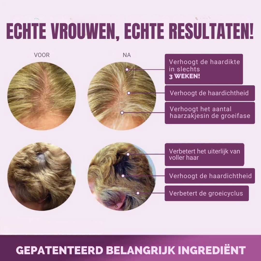 HaarVitaal