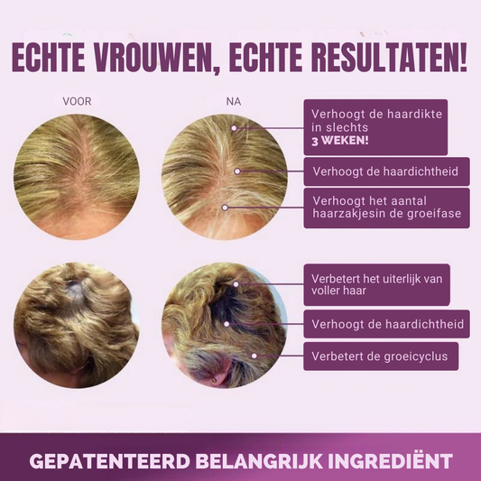 HaarVitaal
